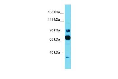 Western Blot: CCDC178 Antibody [NBP2-83966]