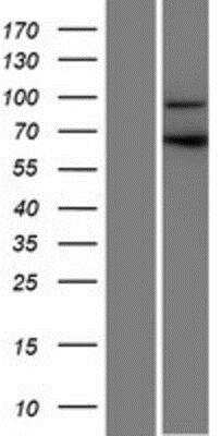 Western Blot: CCDC178 Overexpression Lysate [NBP2-04659]