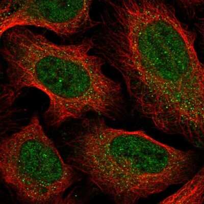 Immunocytochemistry/ Immunofluorescence: CCDC18 Antibody [NBP1-82504]