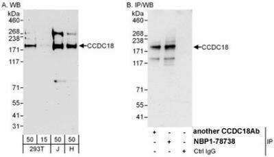 Western Blot: CCDC18 Antibody [NBP1-78738]