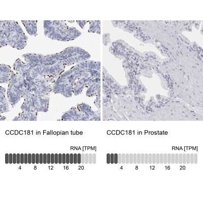 Immunohistochemistry-Paraffin: CCDC181 Antibody [NBP1-93899]