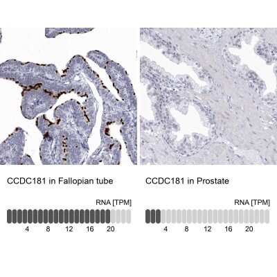 Immunohistochemistry-Paraffin: CCDC181 Antibody [NBP1-93900]