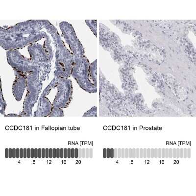 Immunohistochemistry-Paraffin: CCDC181 Antibody [NBP1-93901]