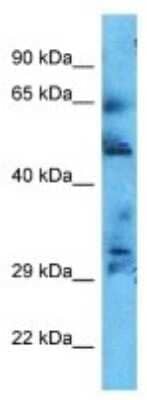 Western Blot: CCDC181 Antibody [NBP3-10643]