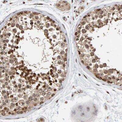 Immunohistochemistry-Paraffin: CCDC182 Antibody [NBP2-47523]