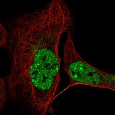 Immunocytochemistry/ Immunofluorescence: CCDC188 Antibody [NBP2-55782]