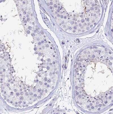 Immunohistochemistry-Paraffin: CCDC19 Antibody [NBP1-91758]