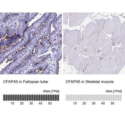 Immunohistochemistry-Paraffin: CCDC19 Antibody [NBP1-91758]