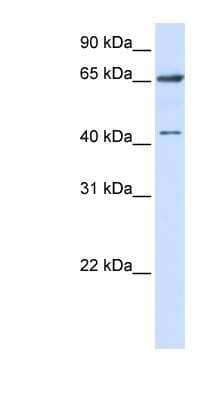 Western Blot: CCDC19 Antibody [NBP1-57843]