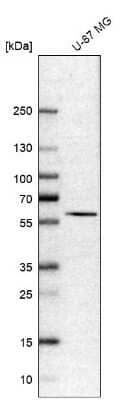 Western Blot: CCDC19 Antibody [NBP1-91758]