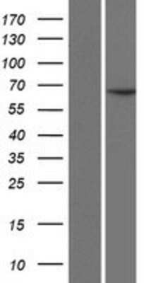 Western Blot: CCDC19 Overexpression Lysate [NBP2-07459]