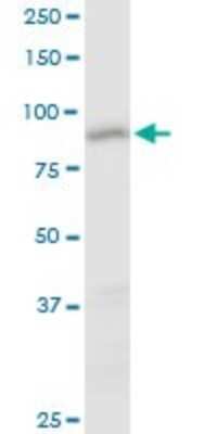 Western Blot: CCDC21 Antibody [H00064793-B01P]