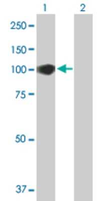 Western Blot: CCDC21 Antibody [H00064793-B01P]