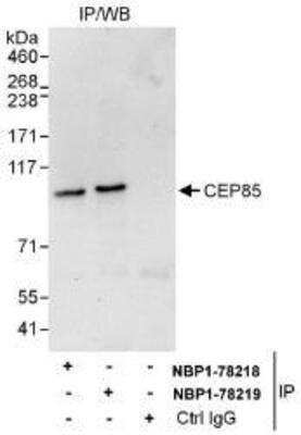 Western Blot: CCDC21 Antibody [NBP1-78218]