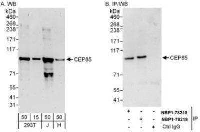 Western Blot: CCDC21 Antibody [NBP1-78219]