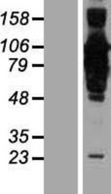 Western Blot: CCDC21 Overexpression Lysate [NBP2-06406]