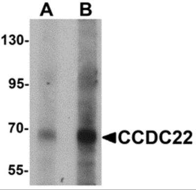 Western Blot: CCDC22 AntibodyBSA Free [NBP2-81708]