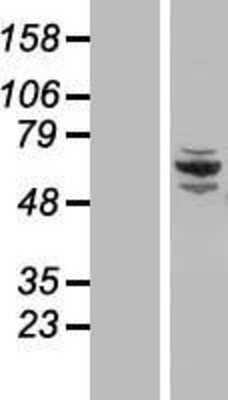 Western Blot: CCDC22 Overexpression Lysate [NBL1-08785]