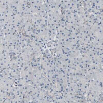 Immunohistochemistry-Paraffin: CCDC23 Antibody [NBP1-81071]