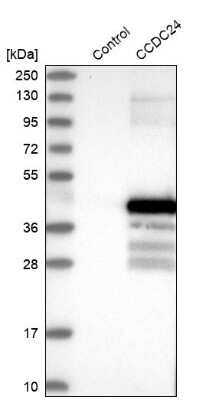 Western Blot: CCDC24 Antibody [NBP2-34179]