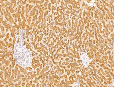 Immunohistochemistry-Paraffin: CCDC25 Antibody [NBP3-12565]