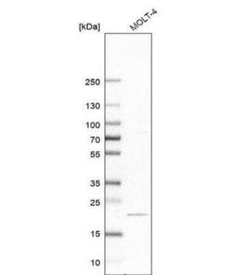 Western Blot: CCDC25 Antibody [NBP1-83821]