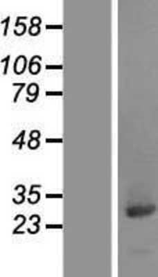 Western Blot: CCDC25 Overexpression Lysate [NBL1-08788]