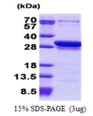 SDS-PAGE: Recombinant Human CCDC25 His Protein [NBP2-22788]