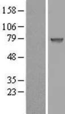 Western Blot: CCDC27 Overexpression Lysate [NBL1-08789]