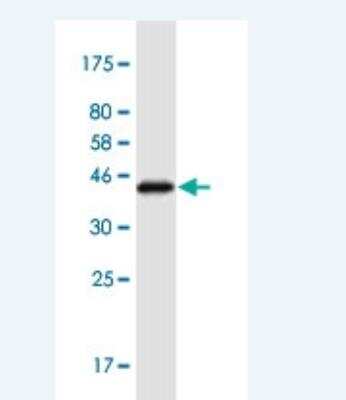 Western Blot: CCDC28A Antibody (6F2) [H00025901-M02-100ug]