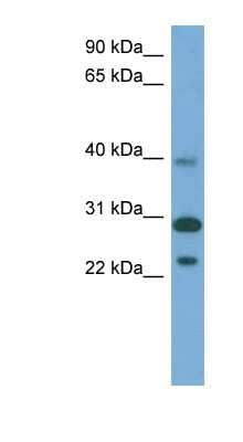 Western Blot: CCDC28A Antibody [NBP1-79581]