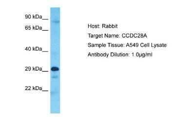 Western Blot: CCDC28A Antibody [NBP2-87147]