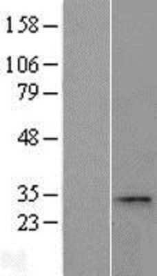 Western Blot: CCDC28A Overexpression Lysate [NBL1-08790]