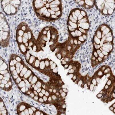 Immunohistochemistry-Paraffin: CCDC28B Antibody [NBP1-81221]