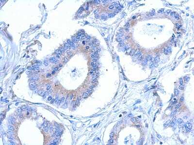 Immunohistochemistry-Paraffin: CCDC28B Antibody [NBP2-15747]