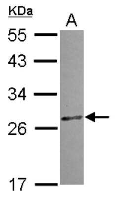 Western Blot: CCDC28B Antibody [NBP2-15747]