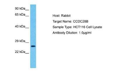 Western Blot: CCDC28B Antibody [NBP2-84607]