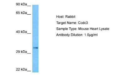 Western Blot: CCDC3 Antibody [NBP2-82576]