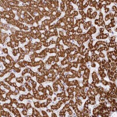 Immunohistochemistry: CCDC30 Antibody [NBP1-93962]