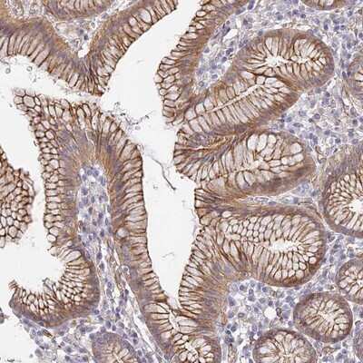 Immunohistochemistry-Paraffin: CCDC30 Antibody [NBP1-93963]