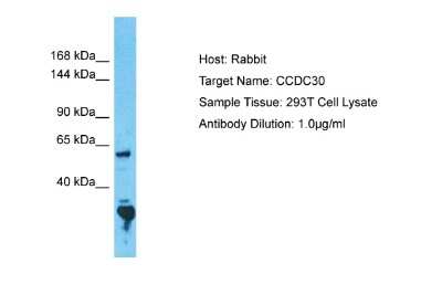 Western Blot: CCDC30 Antibody [NBP2-84608]