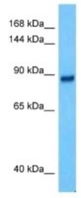 Western Blot: CCDC33 Antibody [NBP3-10808]