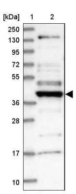 Western Blot: CCDC34 Antibody [NBP1-93558]