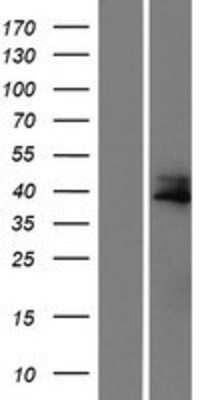 Western Blot: CCDC34 Overexpression Lysate [NBP2-05772]