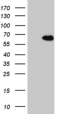 Western Blot: CCDC36 Antibody (OTI2D11) [NBP2-46074]