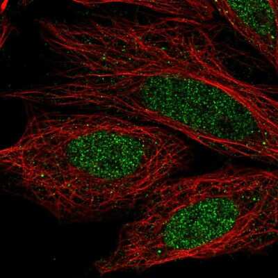 Immunocytochemistry/ Immunofluorescence: CCDC36 Antibody [NBP2-57300]