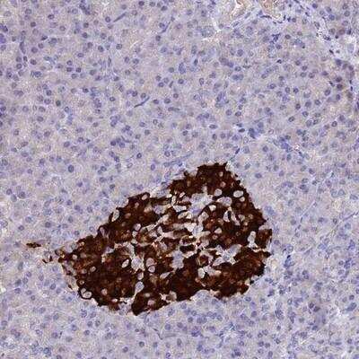 Immunohistochemistry-Paraffin: CCDC36 Antibody [NBP1-91760]