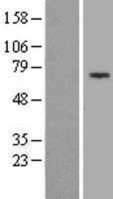 Western Blot: CCDC36 Overexpression Lysate [NBL1-08794]