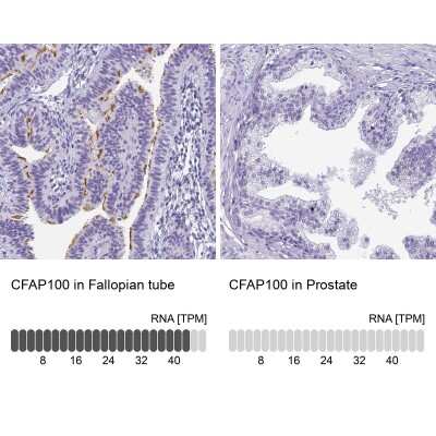 Immunohistochemistry-Paraffin: CCDC37 Antibody [NBP2-14449]