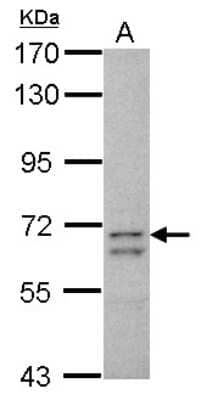 Western Blot: CCDC37 Antibody [NBP2-15748]